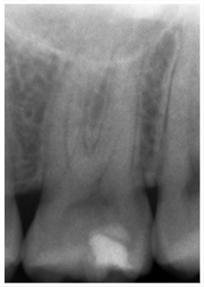 endodontic_1.jpg